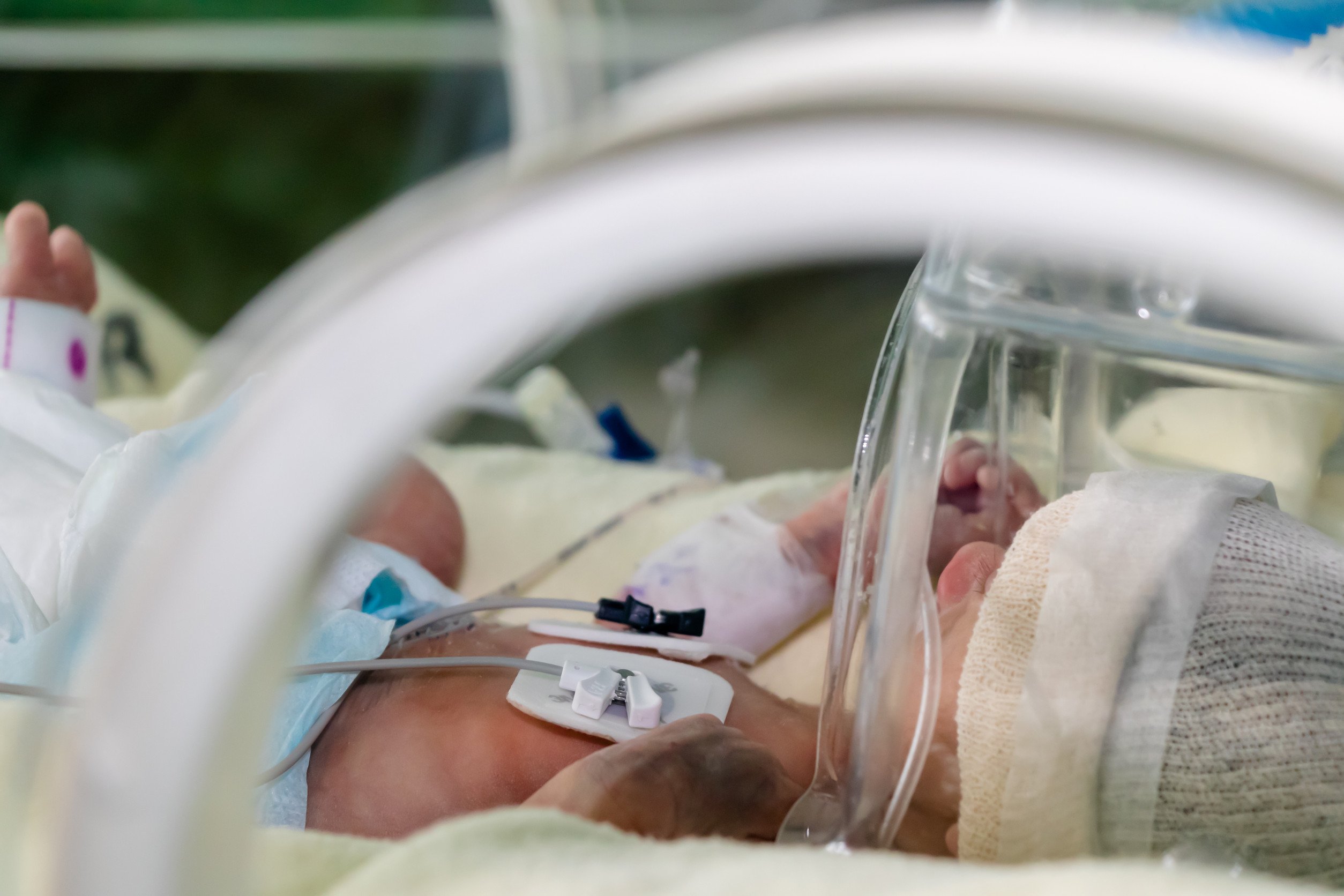 premature infant in an incubator