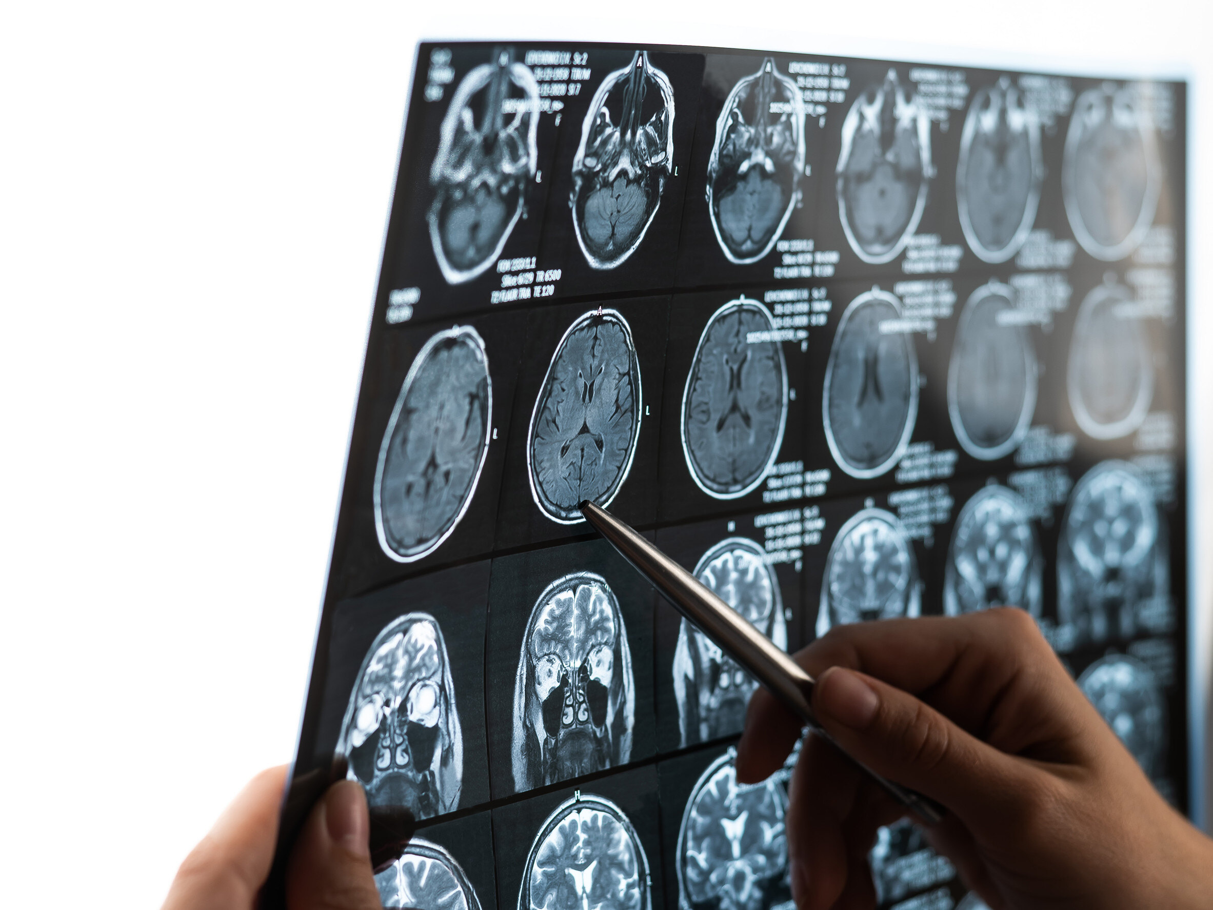 medical expert analyzes brain scans