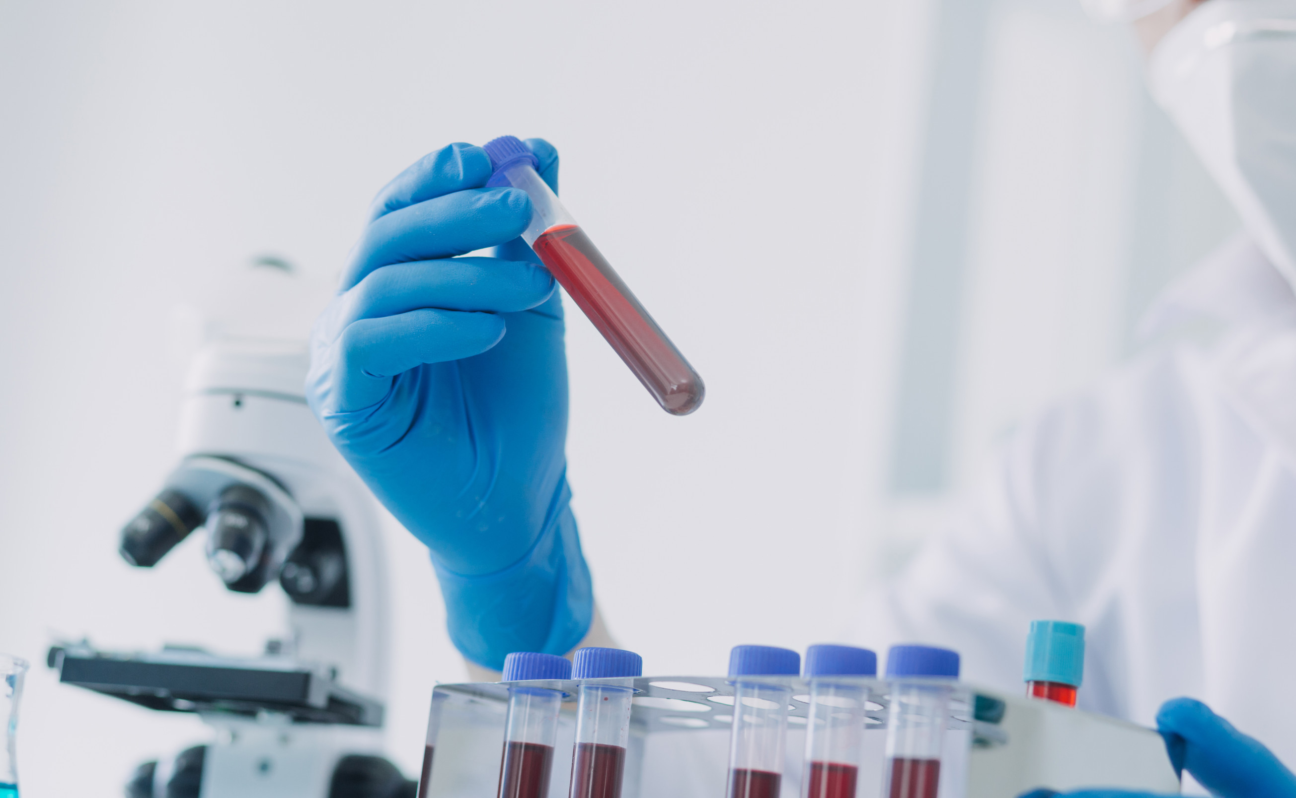 a scientist or medical technician working in a lab handling capped test tubes containing red fluids