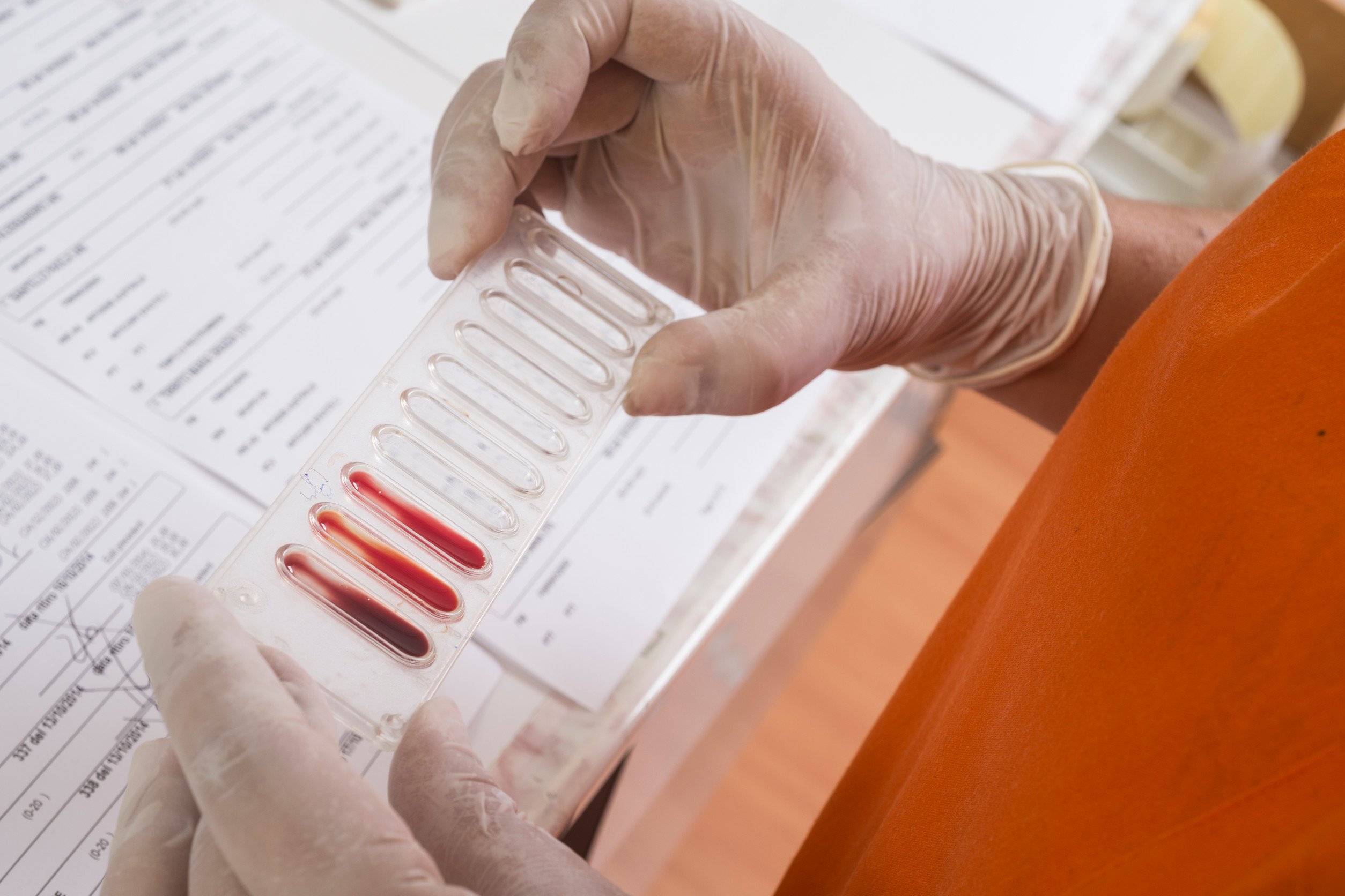 a laboratory technitian examines the results of a blood test